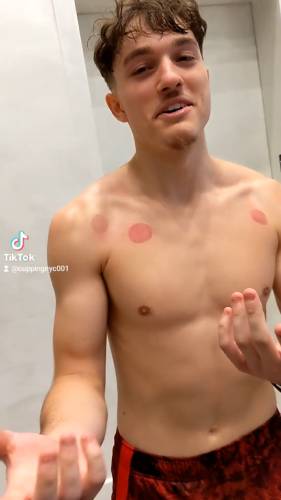 Male Clients Testimonial After Getting Cupping Treatment-1